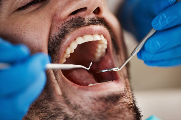 Best Emergency Dental Services for Seniors in St Vincent College, PA